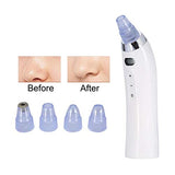 DERMASUCTION 4 in 1 Multi-function Blackhead Whitehead Extractor Remover Device For Men And Women