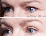 EasyLift The Original 60 Second Eye Lift | As Seen On TV | Lab Tested For Save Everyday Use | Made In America