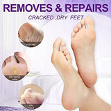 nbc BeautiLab Pedicure Kit Foot Soak Set: Bubble Salt, Sugar Scrub, Massage Mask, Massage Lotion in a Box, 4 Step Foot Spa Kit for Dry Feet, Softens Calluses, Tired Feet（3 Set Lavender)