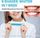 Whitebite Pro Upgraded Teeth Whitening Kit with Pens for Sensitive Teeth: Teeth Whitening LED Light, Mouth Tray, Carbamide Peroxide Whitening Gel - Fast Teeth Whitener and Tooth Stain Remover