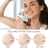 Dark Spot Corrector, Dark Spot Remover For Face and Body Serum | Improves Hyperpigmentation, Facial Freckles, Melasma, Brown Spots