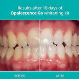 Opalescence Whitening Bundle - Opalescence Go 15% Hydrogen Peroxide Prefilled Whitening Trays (10 Trearments) and Sensitive Whitening Toothpaste 4.7 Onz - Mint Flavor 5194-5167