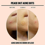 Peace Out Skincare Jumbo Acne Dots. 6-hours Fast Acting Anti-Acne Hydrocolloid Pimple Patches with Salicylic Acid to Help Clear Blemishes Overnight (40 dots)