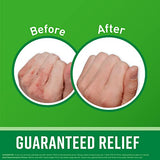 O'Keeffe's Working Hands Hand Cream, Relieves and Repairs Extremely Dry Hands, 3 oz Tube, (Bulk Hand Cream, Pack of 12)