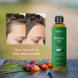 Dersie Batana Oil for Hair Growth: Dr Sebi Organic Raw Batana Oil from Honduras - 100% Pure & Natural - For Thicker & Stronger Hair - 4 FL OZ