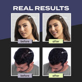 Toppik Hair Building Fibers, Black, 27.5g | Fill In Fine or Thinning Hair | Instantly Thicker, Fuller Looking Hair | 9 Shades for Men & Women