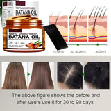 Batana Oil for Hair Growth,Pure and Natural Batana Oil,Batana Oil for Promoting Hair Growth,Prevent Dry Hair,Eliminate Hair Split Ends