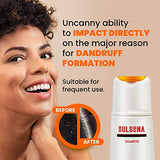 SULSENA anti-dandruff shampoo Bottle 150ml Psoriasis Dandruff Seborrhea Scurf by Amalgama Lux