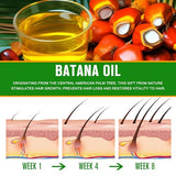 VXHDAG Batana Oil - 100% Pure & Natural from Honduras for Hair Growth, Eliminates Split Ends, Enhances Radiance & Nourishment for All Hair Types, 2.02 fl oz