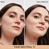 IT Cosmetics Bye Bye Dark Spots Concealer + Brightening Serum – 2% Niacinamide, Hyaluronic Acid & Caffeine - Medium Coverage, Natural Finish, All Skin Types – 11 Fair Neutral, 0.22 fl. oz