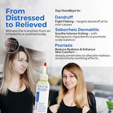 Dermasolve Psoriasis & Dandruff Scalp Oil, Dermatologist Approved for Flaky Scalp Relief