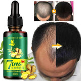 Hair Regrow 7 Day, Ginger Germinal Essential Oil Hair Growth Hair Loss Treatment Hair Care Hair Growth Serum for Men & Women 30ml(2 Pack)