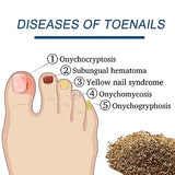 Toenail Fûngus Treatment, 32 Pcs Nail Repair Patches, Nail Repair Treatment for Damaged Nails and Appearance of Discolored