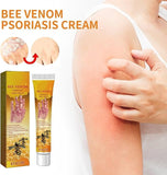 Bee Venom Psoriasis Cream, New Zealand Beevenom Propolis Bee Professional Gel, Soothing Psoriasis Cream-2PCS