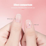 Radiant Nail Growth Oil, 2024 New Cosmetics Nail Growth Oil Radiant Nail Growth Oil Pen, Upgraded Cuticle Oil for Nails Strengthener for Moisture Strengthen Brighten Nails Care (Rose 2PCS)