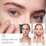Celyn Instant Firm Eye Tightener, Eye Bag Cream 30ML New