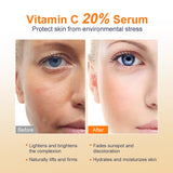 Bioglossy Vitamin C Serum 20%, Professional Vitamin C Face Serum Anti Aging Skin Care for Women 30 ml / 1 Fl oz