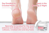 CLEAR 40 +SA, 40% Urea Gel + 2% Salicylic Acid, 4 oz w/Tea Tree & Coconut Oil, Aloe Vera, Callus & Corn Remover Softens Cracked Heels, Feet, Elbows, Hands, Nails, Superior hydration to Urea Creams