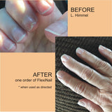 FlexiNail Penetrating Fingernail Conditioner and Strengthener to repair and then maintain weak and peeling or brittle and splitting nails