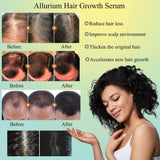 Allurium Hair Growth Serum Designed for Black Women with Herbs and Natural Vitamin (4 Pack)