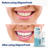 EVERSMILE AlignerFresh Extra Whitening Aligner & Retainer Cleaning Foam. AlignerFresh Cleaning Foam for Invisalign, ClearCorrect, Essix, Hawley Trays/Aligners. Cleans, Kills Bacteria & Whitens Teeth.