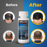 Minoxidil Liquid Extra Strength Hair Regrowth Treatment for Men, 5% Topical Solution, 6 Months Supply - Dropper Applicator and Bonus Free Instructional Guide Included