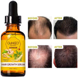 5 Pack Hair Growth Serum,Ginger Biotin Hair Regrowth Serum Prevent Hair Loss and Natural Serum for Thicker, Stronger, Longer Hair Men and Women