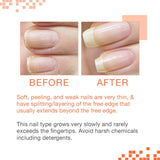 Nail Tek Treatments Intensive Therapy 2 | Nail Strengthener for Soft and Peeling Nails | Professional Refill | 4 Fl. Oz.