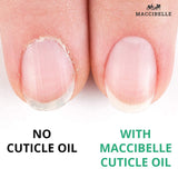 Maccibelle Cuticle Oil Pinapple Refill size Hydrating Oil For Repaired Cuticles Overnight - For Damaged Skin And Dry Cuticles (Pineapple 16oz)