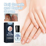 Onyxoguard Nail Growth And Repair Serum, 1/2/3 Pcs Onyx Guard Nail, Onyxoguard Serum, Onyxoguard Nail Repair Serum,Nail Strengthener For Thin Nails And Growth (2pcs)