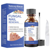 Nail Repair Solution - Gentle Treatment for Healthy Nails