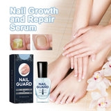 Onyxoguard Nail Growth And Repair Serum, 1/2/3 Pcs Onyx Guard Nail, Onyxoguard Serum, Nail Strengthener For Thin Nails And Growth,Revitalize And Strengthen Your Nails (3 Pcs)