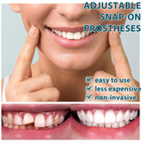 Kahxi Temporary Teeth Perfect Cover,Adjustable Snap On,Moldable False Teeth for Beautiful Smile,Nature and Comfortable