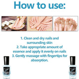 Onyxoguard Nail Growth and Repair Serum, Onyxoguard Serum, Nail Strengthener, OnycholysisHeal Nail Strengthening and Growth Conditioner, for Thin Nails And Growth (4pcs)