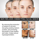 Melanin Correcting Facial Serum, Vitamin C Serum for Face with, Dark Spot Corrector Daily Face Serum (2Pack)