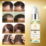 LILIVERA Hair Growth Serum, Rosemary Oil for Hair Growth, Hair Loss Treatment, Hair Oil for Dry Damaged Hair and Growth, Hair Growth Products for Women, Stimulates Hair Growth for hair thickener, Nourishes The Scalp, Improves Scalp Circulation 2.02 Oz