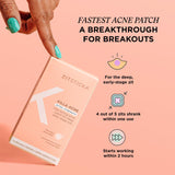 ZitSticka Killa Kit | Self-Dissolving Microdart Acne Pimple Patch for Zits and Blemishes | Spot Targeting for blind, early-stage, hard-to-reach zits for Face and Skin, Extra Strength (4 Pack)