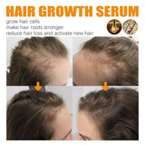 Folix22 Hair Growth Formula | Folix22 Hair Growth Serum | Folix22 Hair Growth Oil | Natural Hair Oils for Hair Growth | Nourishing Hair Oil | for Thinning and Damaged Hair (1pc)