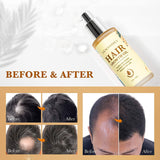 Biotin Hair Growth Oil for Women and Men, Hair Growth Serum for Thicker Longer Fuller Healthier Hair, Prevent Hair Loss & Thinning, dry damaged, All Natural Vitamin Rich Treatment, All Hair Types - 2 Pack