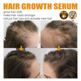 Biotin Premium Hair Growth Serum, Biotin Thickening Herbal Serum, Anti Hair Loss Nourish Dry Damaged Hair Repair,Biotin Herbal Serum for Thicker Longer & Stronger Hair,30ML (2pcs)