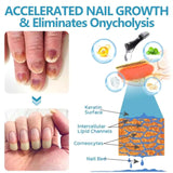 Onyxoguard Nail Growth and Repair Serum, Onyxoguard Serum, Nail Strengthener, OnycholysisHeal Nail Strengthening and Growth Conditioner, for Thin Nails And Growth (4pcs)