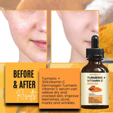 DERMAXGEN Turmeric Face Serum + Vitamin C: Organic Moisturizer for Acne Reduction, Clear Skin Tone, & Anti-Aging Benefits - Hydrate Dull & Dry Skin - Facial Serum - 4 FL OZ