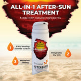 All-in-One AfterBurn Tan Recovery Lotion – Doctor-Formulated Aftersun Lotion w/ Natural Ingredients & 14 Essential Oils for All Ages – After Sun Care Lotion for Deep Hydration & Peeling Minimization