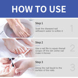 Nail Repair Solution - Gentle Treatment for Healthy Nails