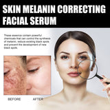 Melanin Correcting Facial Serum, Vitamin C Serum for Face with, Dark Spot Corrector Daily Face Serum (2Pack)