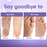 Foot Peel Mask (5 Pairs) - Foot Mask for Baby Soft Skin - Remove Dead Skin, Dry, Cracked Feet & Callus, Foot Spa, Made with Aloe Vera Extract for Women and Men Feet Peeling Mask Exfoliating, Lavender