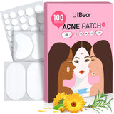 LitBear Large Acne Pimple Patches, 6 Sizes 100 Patches for Large Breakouts, Acne Patches for Face, Chin or Body, Acne Spot Treatment with Tea Tree & Calendula Oil, Hydrocolloid Bandages for Acne Skin