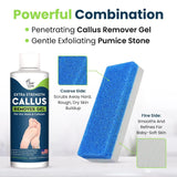 Callus Remover for Feet with Extra Strength Gel & Foot Pumice Stone Set - Easy Way to Remove Hard Calluses & Dead Skin Build-Up - Professional at-Home Foot Care for Men & Women - Made in The USA