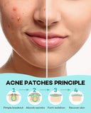 Acne Patch Pimple Patch, 4 Sizes 420 Patches Acne Absorbing Cover Patch, Hydrocolloid Invisible Acne Patches For Face Zit Patch Acne Dots Tea Tree, Calendula Oil - 3 Pack