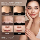 Insutam Forehead Wrinkle Patches for Anti-wrinkles: Smile Line Remover Pads - Overnight Lift Lines Treatment 12prs